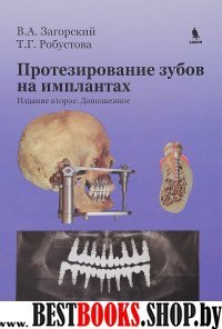 Протезирование зубов на имплантах. 2-е изд.,доп