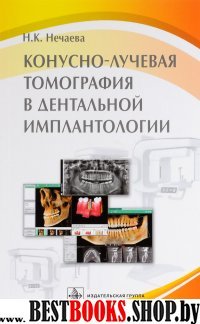 Конусно-лучевая томография в дентальн.имплантолог.