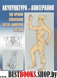 Акупунктура и апитерапия при лечении заболеваний костно-мышечной сист