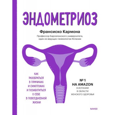 Эндометриоз. Как разобраться в причинах, распознать симптомы