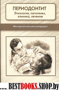 Периодонтит. Этиология, патогенез, клиника,лечение