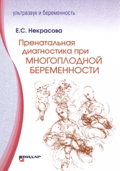 Пренатальная диагностика при многоплодной беременности