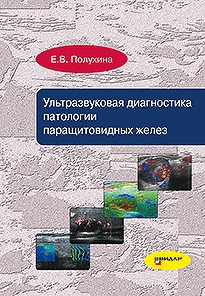 Ультразвуковая диагностика патологии паращитовидных желез