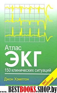 Атлас ЭКГ. 150 клинических ситуаций