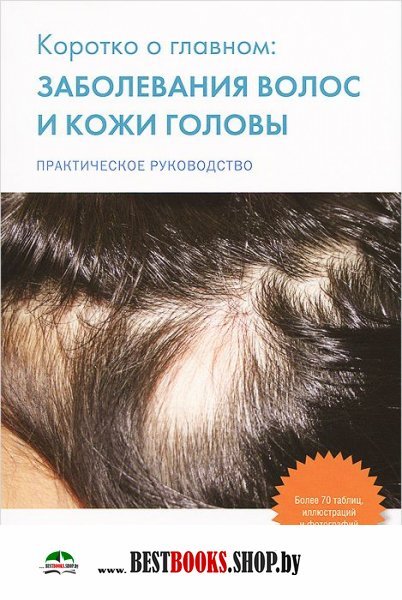 Заболевание волос и кожи головы