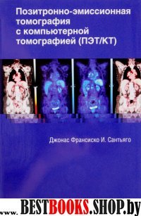 Позитрон.-эмисионная томограф.с компьют.томографии