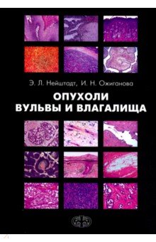 Опухоли вульвы и влагалища