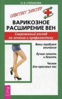 Варикозное расширение вен. Советует доктор