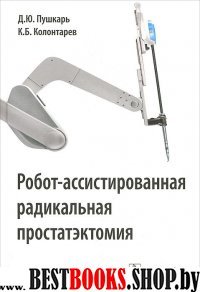 Робот-ассистированная радикальная простатэктомия