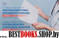 Электрокардиограмма при инфаркте миокарда.Атлас (на русс. и англ.яз.)