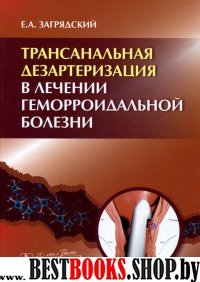 Трансанальн.дезартериз.в лечении геморроид.болезни