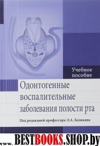 Одонтогенные восполительные заболевания полости рта.Уч.пос