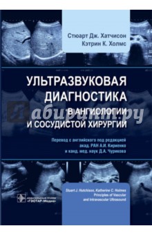 Ультразвуковая диагностика в ангиологии и сосудистой хирургии