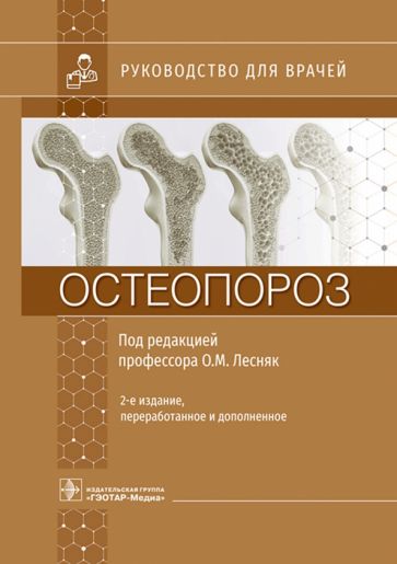 Остеопороз