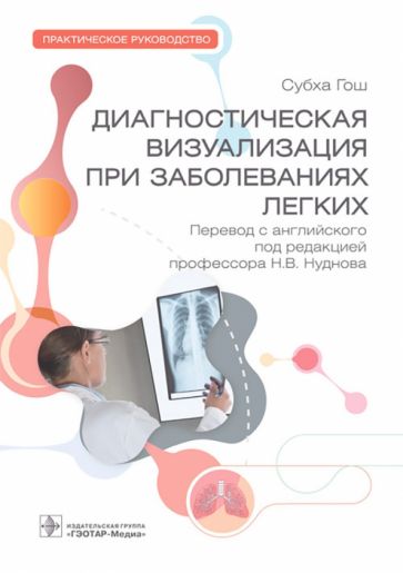 Диагностическая визуализация при заболеваниях легких.Практич.руковод.