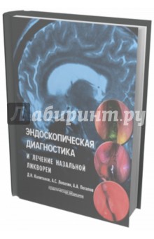 Эндоскопическая диагност.и леч. назальной ликвореи