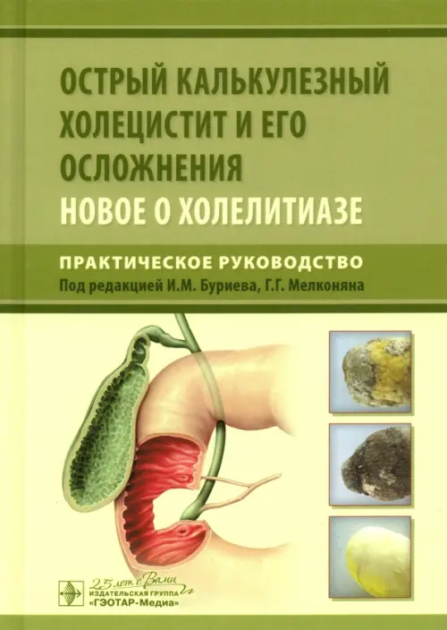 Острый калькулезный холецистит и его осложнения. Новое о холелитиазе. Практическое руководство