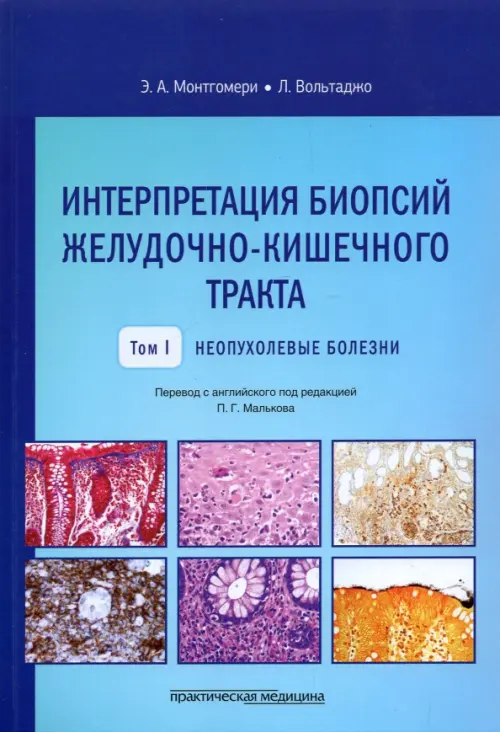 Интерпретация биопсий желудочно-кишечного тракта. Том 1. Неопухолевые болезни