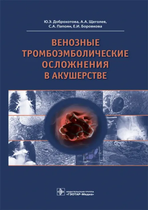 Венозные тромбоэмболические осложнения в акушерстве