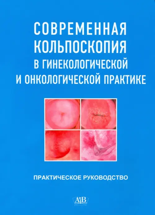 Современная кольпоскопия в гинекологической и онкологической практике