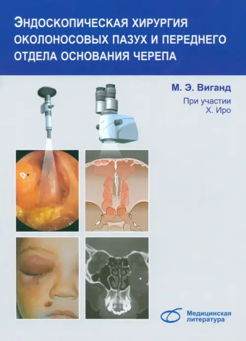 Эндоскопическая хирургия околоносовых пазух и переднего отдела основания черепа