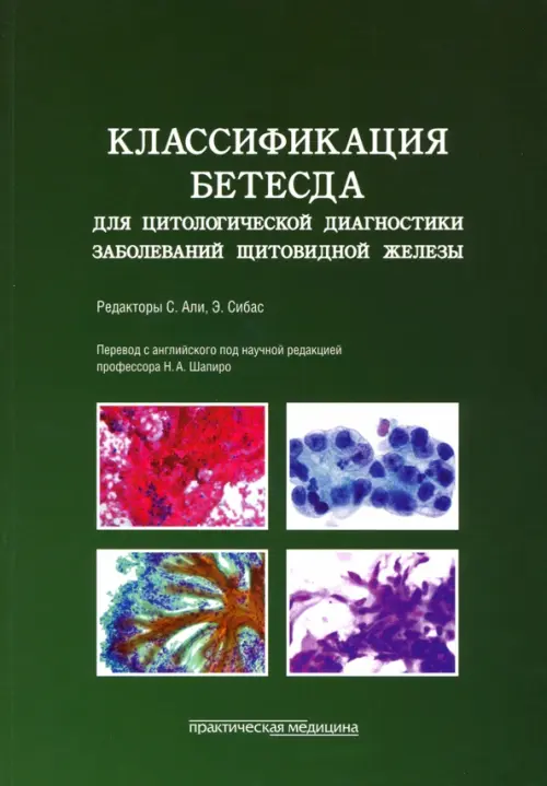 Классификация Бетесда для цитологической диагностики заболеваний щитовидной железы. Терминология