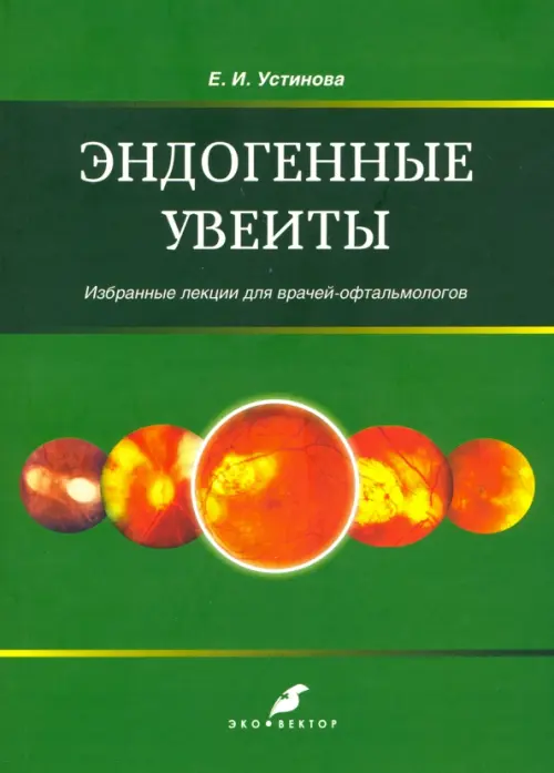 Эндогенные уевиты. Избранные лекции для врачей-офтальмологов