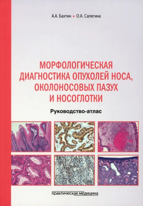 Морфологическая диагностика опухолей носа, околоносовых пазух и носоглотки. Руководство-атлас