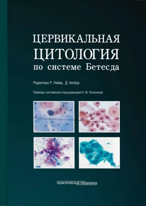 Цервикальная цитология по системе Бетесда. Терминология, критерии и пояснения