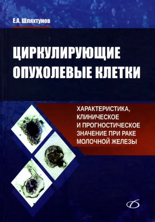 Циркулирующие опухолевые клетки. Характеристика, клиническое и прогностическое значение при раке