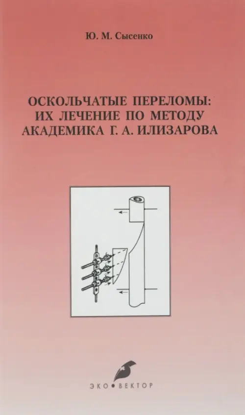 Оскольчатые переломы. Их лечение по методу академика Г. А. Илизарова. Монография