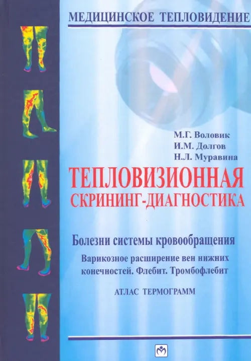 Тепловизионная скрининг-диагностика. Болезни системы кровообращения. Варикозное расширение вен