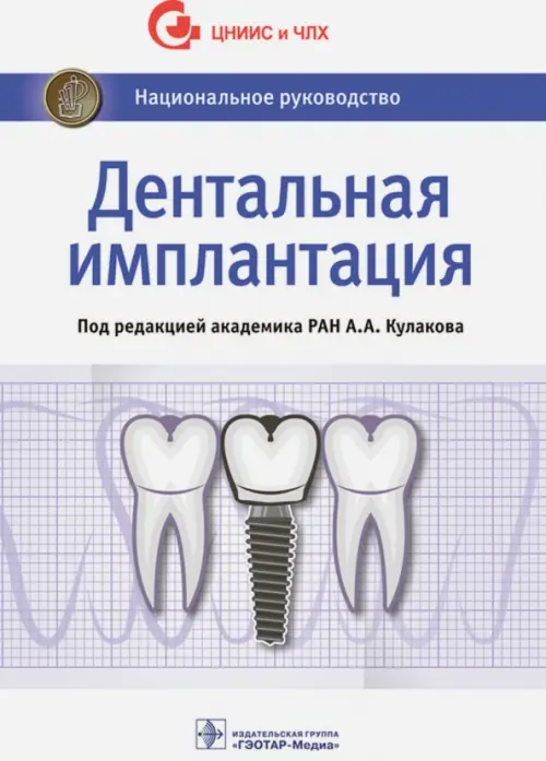 Дентальная имплантация. Национальное руководство