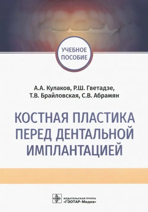 Костная пластика перед дентальной имплантацией. Учебное пособие