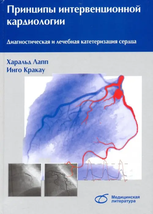 Принципы интервенционной кардиологии. Диагностическая и лечебная катетеризация сердца