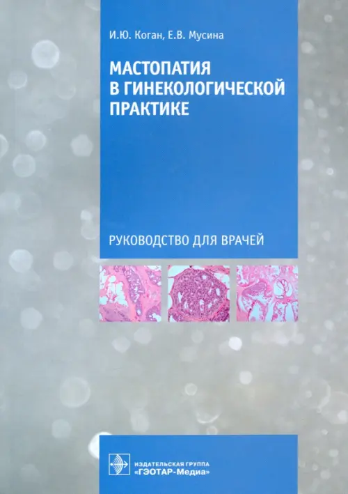 Мастопатия в гинекологической практике. Руководство для врачей