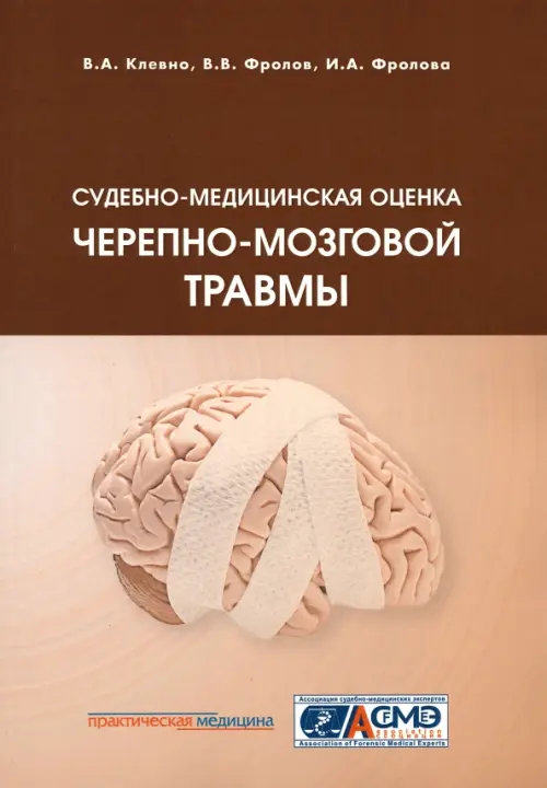 Судебно-медицинская оценка черепно-мозговой травмы