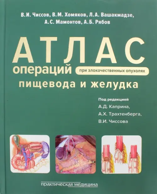 Атлас операций при злокачественных опухолях пищевода и желудка