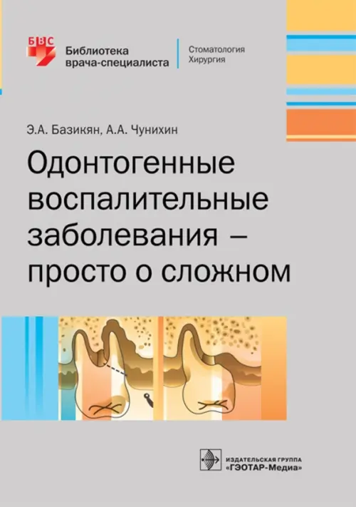 Одонтогенные воспалительные заболевания - просто о сложном